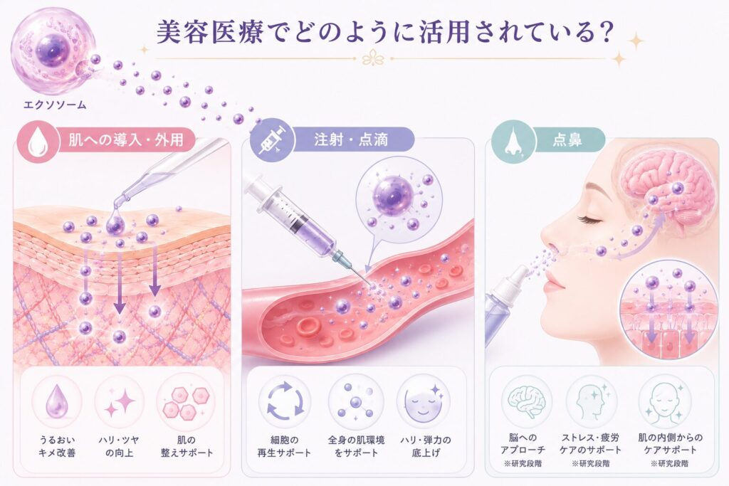美容医療におけるエクソソームの主な活用方法として、肌への導入・外用、注射・点滴、点鼻の3つをイラストで比較した図。それぞれ異なる方法でエクソソームを取り入れる特徴をわかりやすく示している。