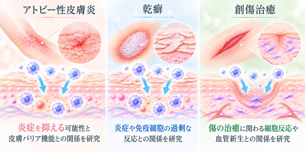 アトピー性皮膚炎・乾癬・創傷治癒に関するエクソソーム研究を示した図解。左側は皮膚の赤みやバリア機能の乱れが見られるアトピー性皮膚炎、中央は皮膚が厚くなり鱗屑(りんせつ)が生じる乾癬、右側は傷ついた皮膚の組織が修復されていく創傷治癒を表している。それぞれのイラストを通じて、エクソソームを含む細胞外小胞が炎症反応の調節や皮膚の状態、組織の修復に関わる可能性について研究されていることを、淡い色調でわかりやすく解説している。