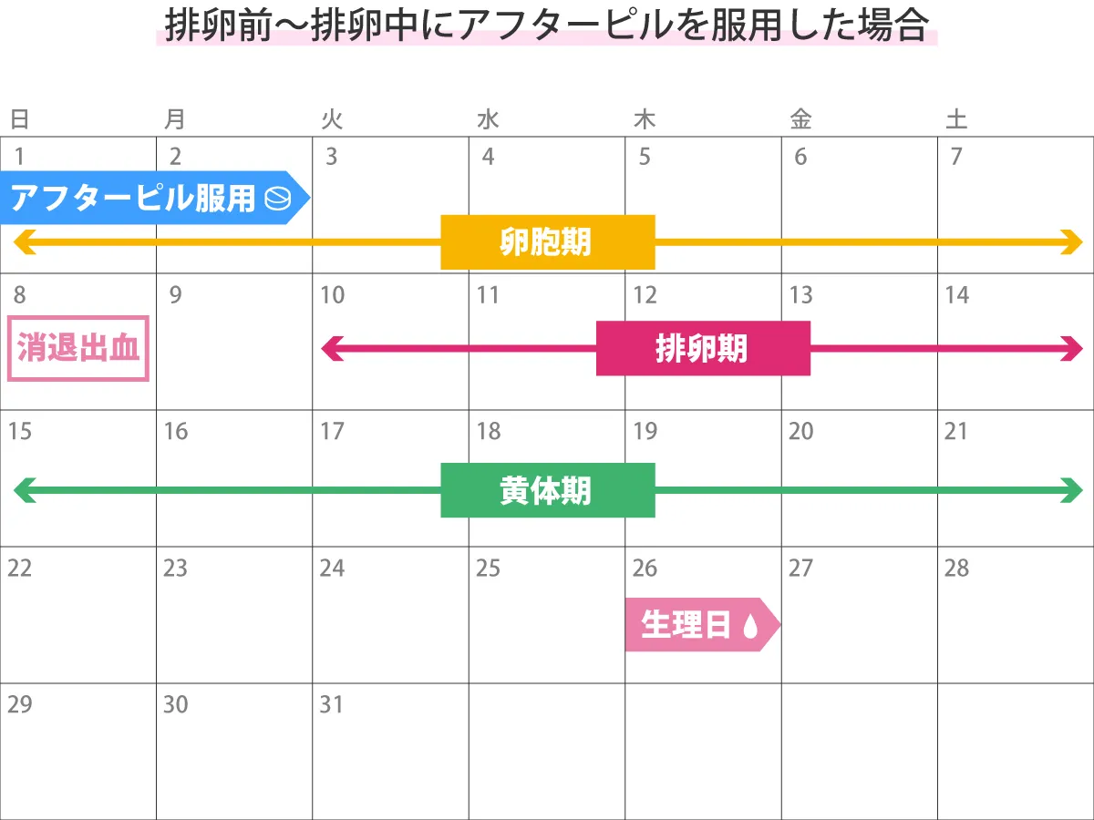 なぜ消退出血が起こるのでしょうか?